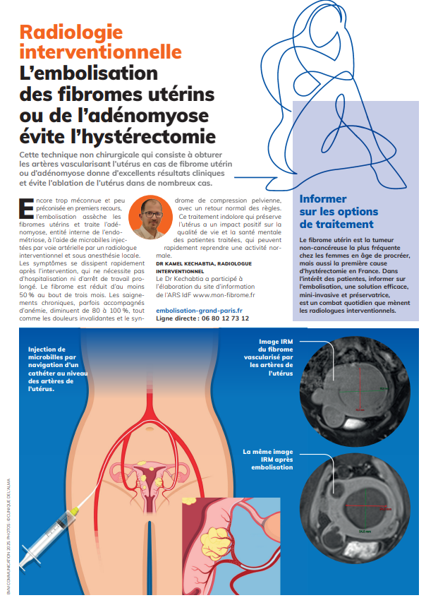 Et si l’on pouvait éviter l’hystérectomie ?